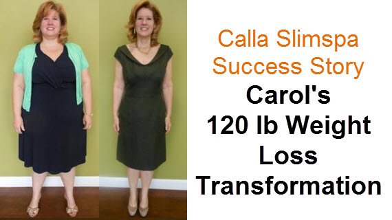 Illustrator of calla slimspa 120lb weight loss transformation
